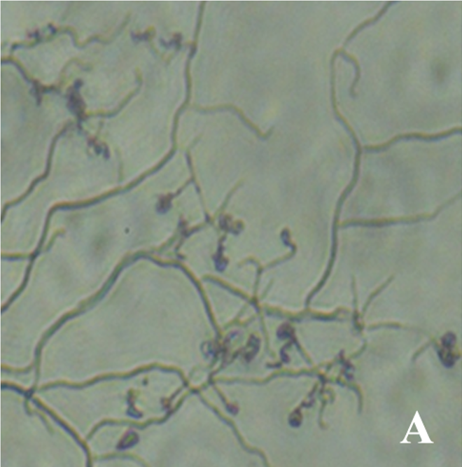 Microphotograph showing spore chain morphology of S. mirabilis TBGS10.